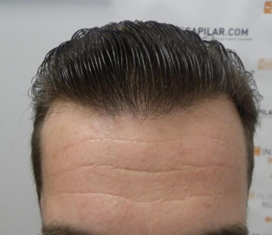 708_011110_430000001.jpg