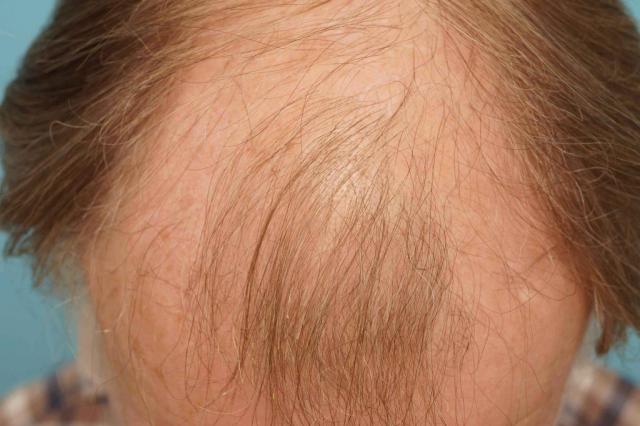 708_141615_540000003.jpg