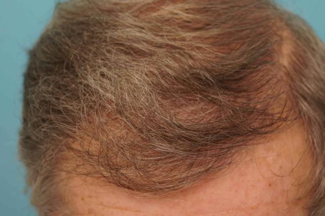 708_290552_400000001.jpg