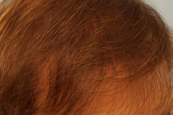 708_311323_330000001.jpg