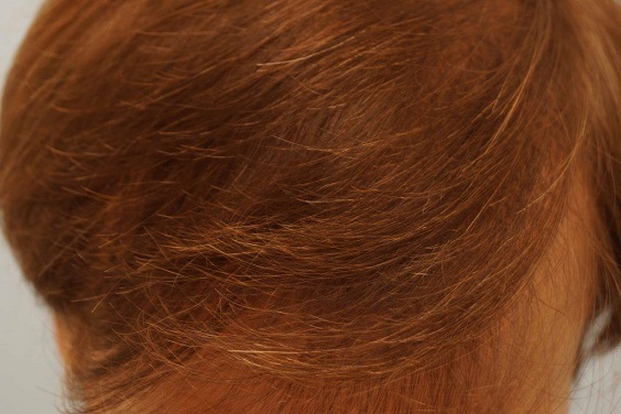 708_311323_330000002.jpg