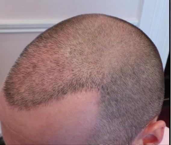 879_040750_200000000.jpg