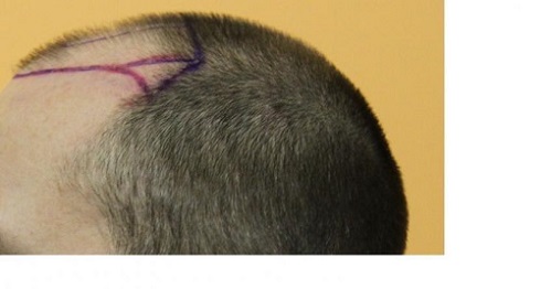 879_291349_530000002.jpg