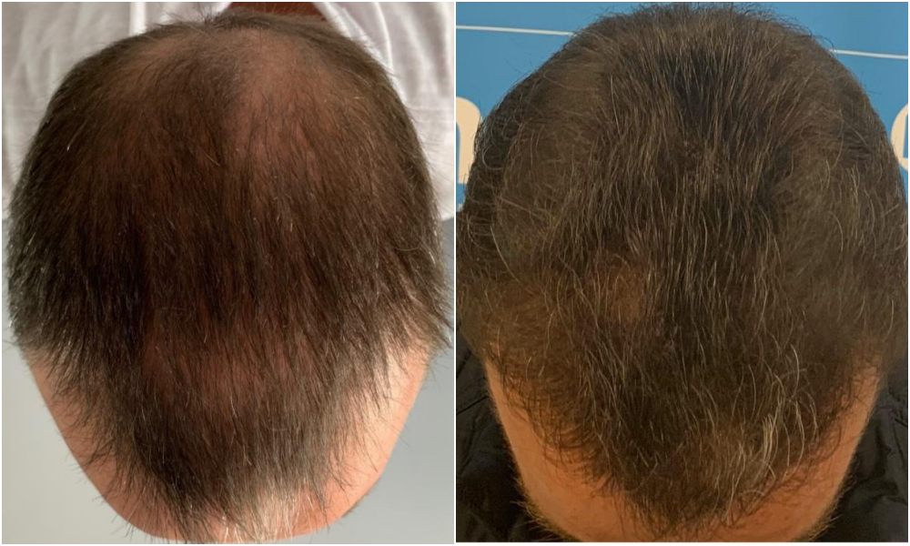 4. before-after-top. ben-thornley.png