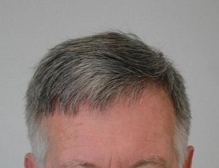 743_241031_140000002.jpg